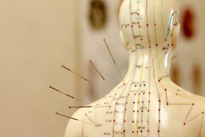 طب سوزنی چیست و آیا برای آرتروز و درد سیاتیک مفید است؟